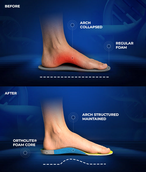 Biomechanics