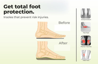 Foot diagram showing before-and-after insole support, with relief for flat feet, heel pain, and plantar fasciitis